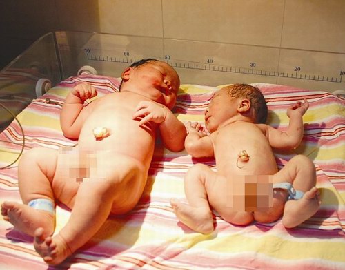 30岁产妇在市人民医院生下5.6公斤男婴