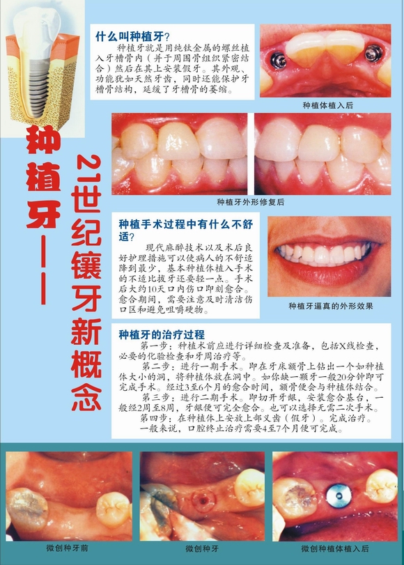 爱牙日口腔宣教之五（种植牙）