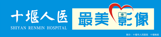 最美影像之三：李敬会，敬老爱老的“铿锵玫瑰”