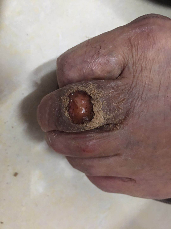 把三甲医院的技术带到白河县，让患者少跑路又省钱